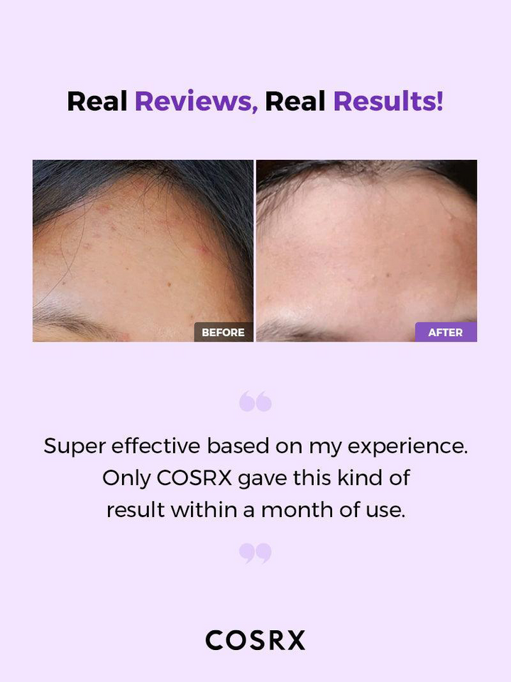 “COSRX AHA/BHA Clarifying Treatment Toner – Exfoliating & Brightening”
